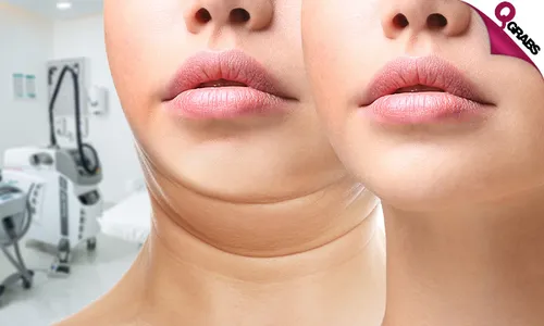 HIFU Skin Tightening Sessions!